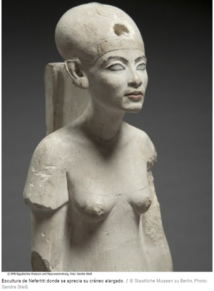Akenatón y Nefertiti fueron siempre representados con cráneos anormalmente alargados.