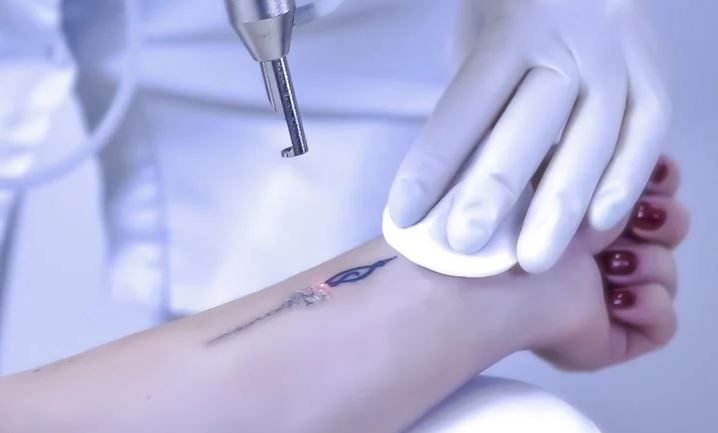 Los tatuajes electrónicos se encuentra aún en etapa de prototipo.