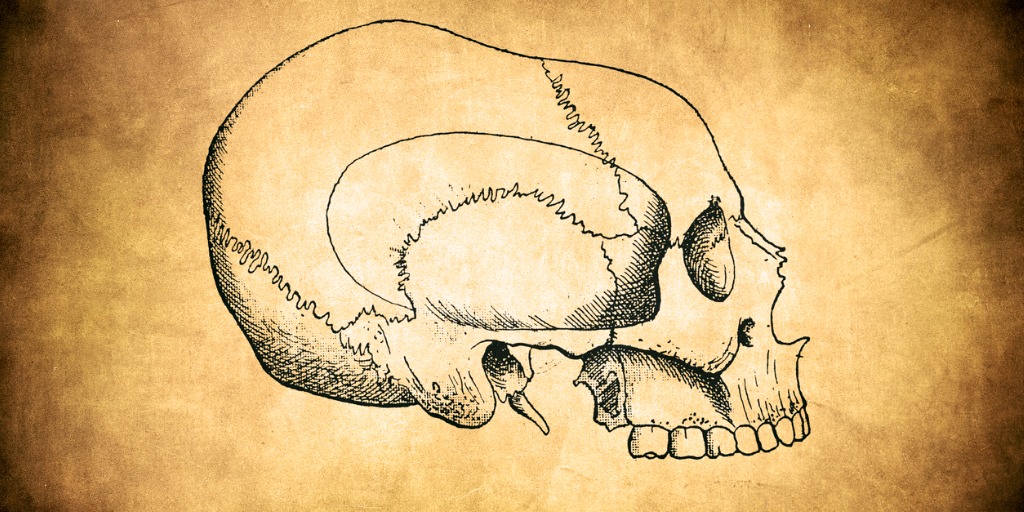 Ilustración de un cráneo con microcefalia.