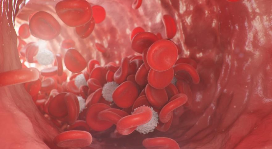 Descubren microplásticos en los vasos sanguíneos humanos