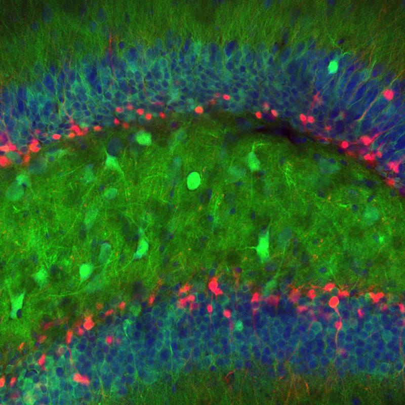Revolucionario estudio logró observar por primera vez el nacimiento de nuevas neuronas-0